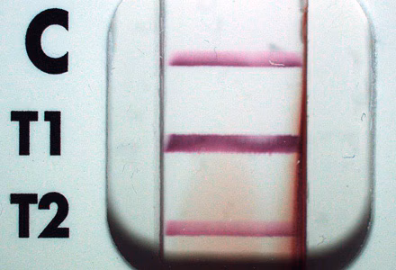 February - 2016 - Case #413