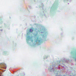 February - 2016 - Case #414