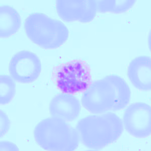 April - 2016 - Case #418