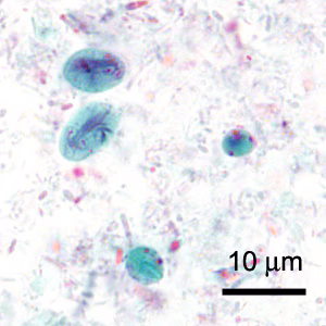 May - 2016 - Case #419