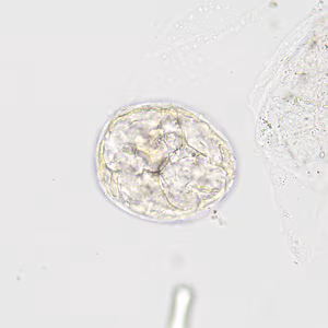 June - 2016 - Case #422