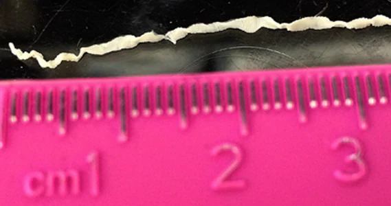 August - 2016 - Case #425