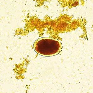 September - 2016 - Case #427