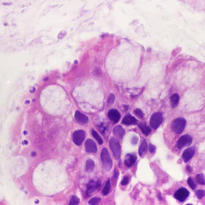 September - 2016 - Case #428