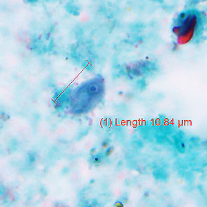 October - 2016 - Case #429