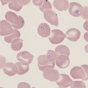 November - 2016 - Case #431