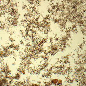 December - 2016 - Case #433