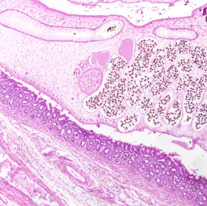 JANUARY - 2017 - Case #436