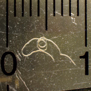 FEBRUARY - 2017 - Case #437