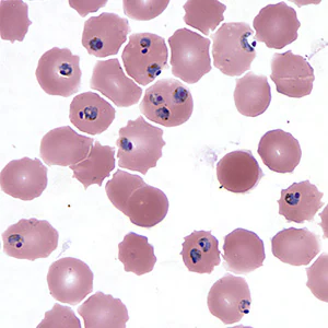 MARCH - 2017 - Case #439