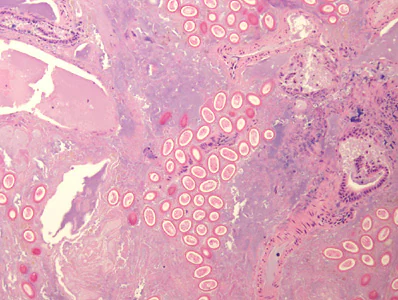 APRIL - 2017 - Case #442