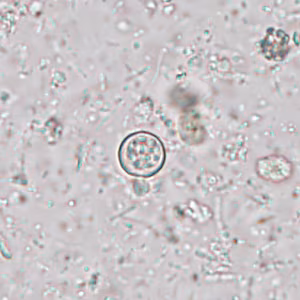 JUNE - 2017 - Case #445 case445