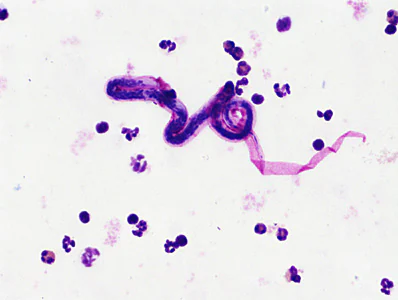 JUNE - 2017 - Case #446 case446