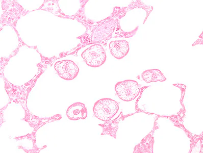 Case448_A parasitic image