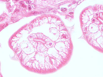 Case448_C parasitic image