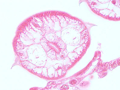 Case448_D parasitic image