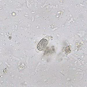 SEPTEMBER - 2017 - Case #452 Case Study Image