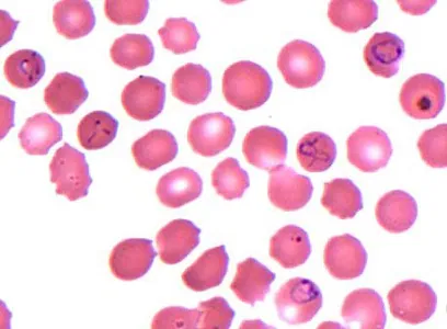 OCTOBER - 2017 - Case #453 parasitic image