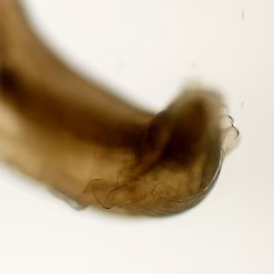 Case455_C Parasitic image