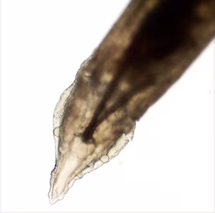 Case455_D Parasitic image