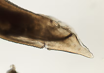 Case455_E Parasitic image