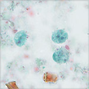 NOVEMBER - 2017 - Case #456 parasitic image