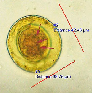parasitic image answer