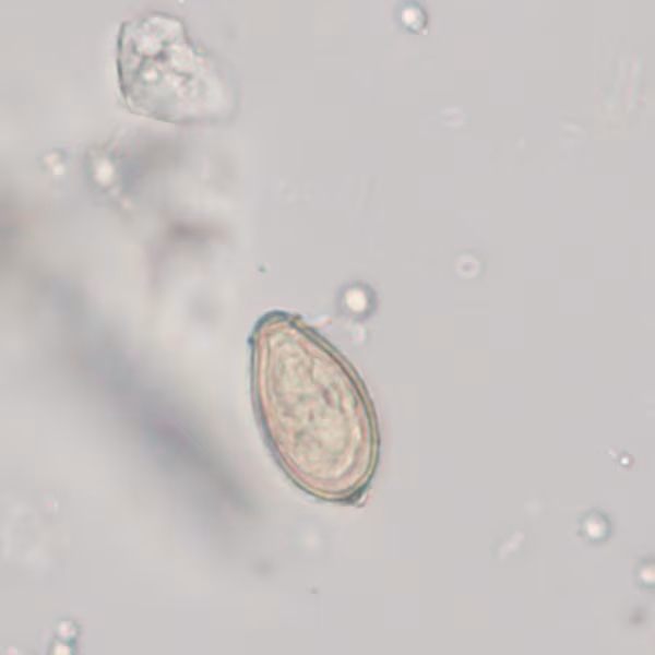 NOVEMBER - 2020 - CASE #527 parasitic image