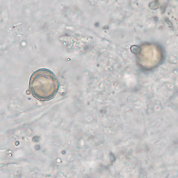 NOVEMBER - 2020 - CASE #528 parasitic image