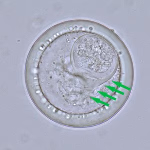 Case_513_B_Answer Case_513_B_answer