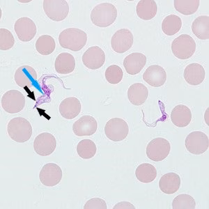 Case_514_B_Answer Case_514_answer