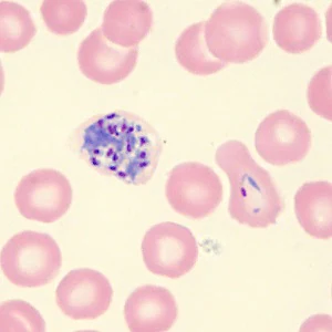 Case_515_F Case_515_F