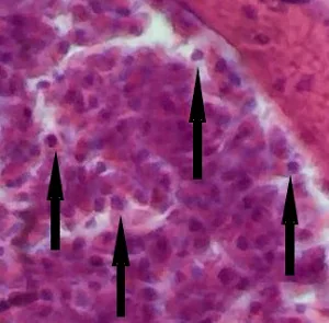 Case_519_B_Answer Case_519_B_answer