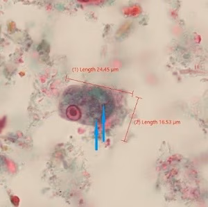 Case_520_A_Answer Case_520_answer