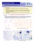 Laboratory Diagnosis of Plasmodium falciparum