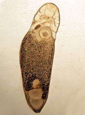 Philophthalmiasis image