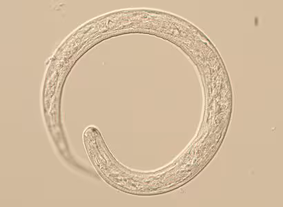 Figure A: L1 larva of Thelazia sp., likely T. callipaeda based on the patient’s travel history. L1 larvae measure up to 400 µm long and 13.5 µm wide. While not visible on this specimen, normally larvae are passed encased in a shell membrane.
