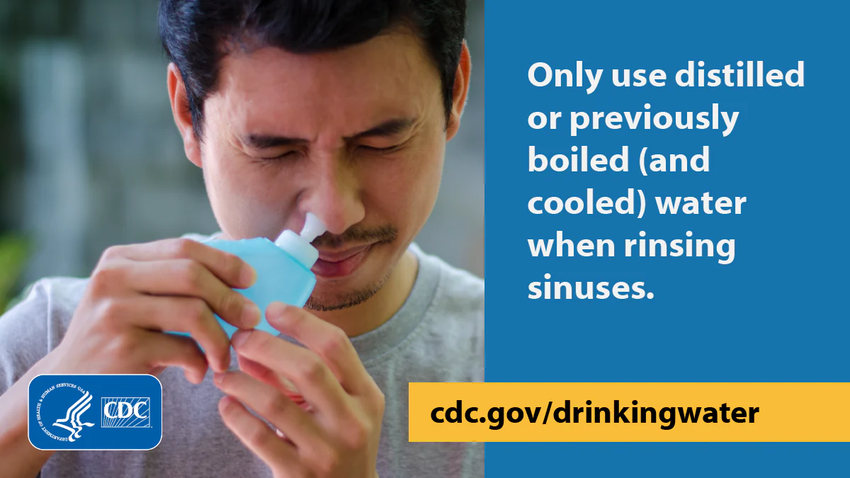 Sinus rinsing graphic English 1200x675 Person with their eyes closed putting a neti pot in their nostril. Text to the right of the image says, “Only use distilled or previously boiled (and cooled) water when rinsing sinuses.”