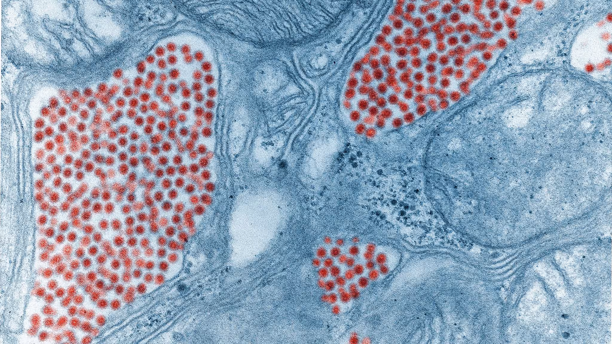 Electron microscope image of eastern equine encephalitis virus