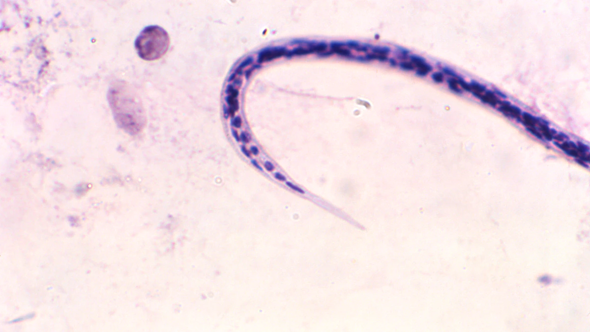 O. volvulus posterior Posterior view of O. volvulvus