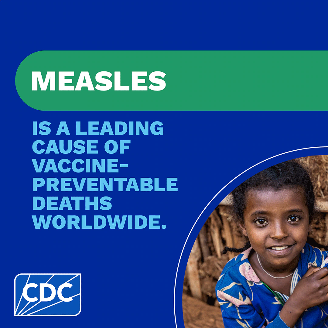 Learn About Measles animated Learn about how CDC is addressing the global threat of measles.