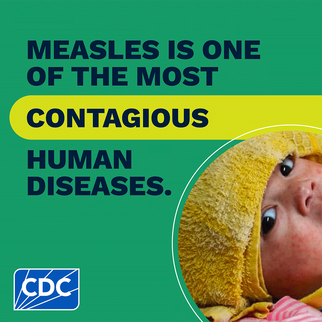 Measles is a tracer animated Measles is one of the most contagious human diseases.