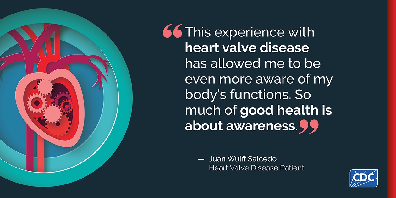 HVD-SS-Juan-1260x630 Juan Wulff Salcedo, heart valve disease patient