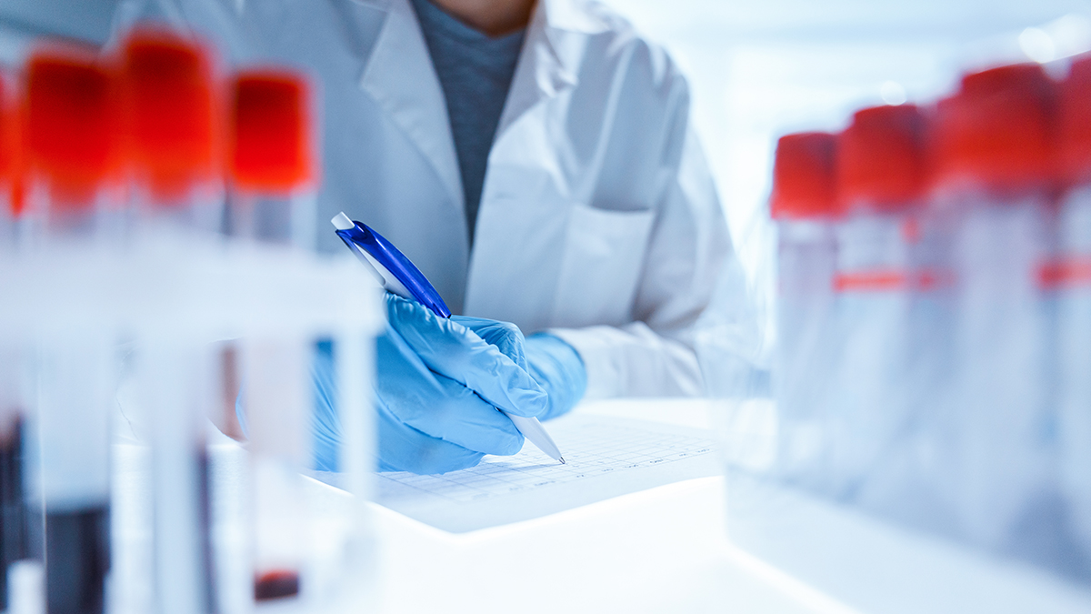 Viral Hepatitis Laboratory Testing Healthcare professional in their lab conducting hepatitis laboratory testing