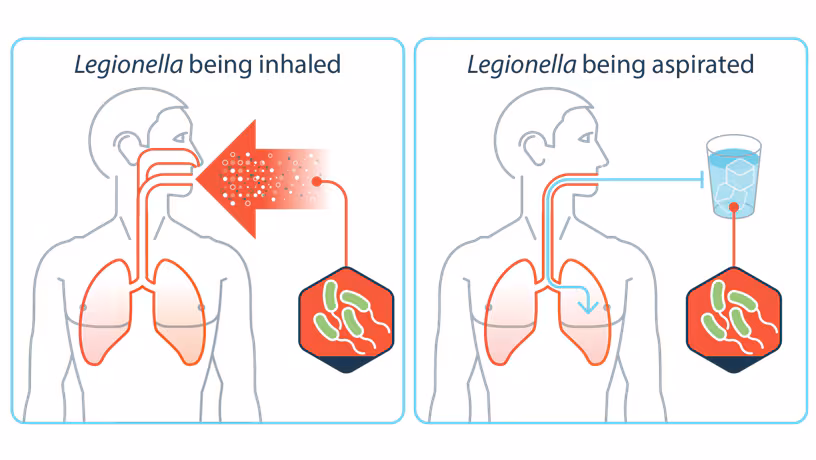 Illustrations showing a person inhaling small droplets of water containing Legionella and getting water in their lungs while drinking.