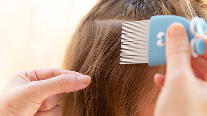 combing for head lice Adult using fine-toothed comb on child's hair.
