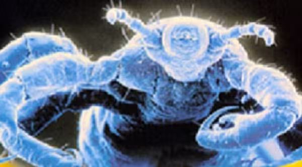 Head lice