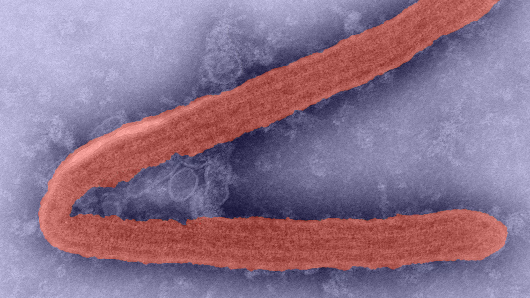 A microscopic image of the Marburg virus