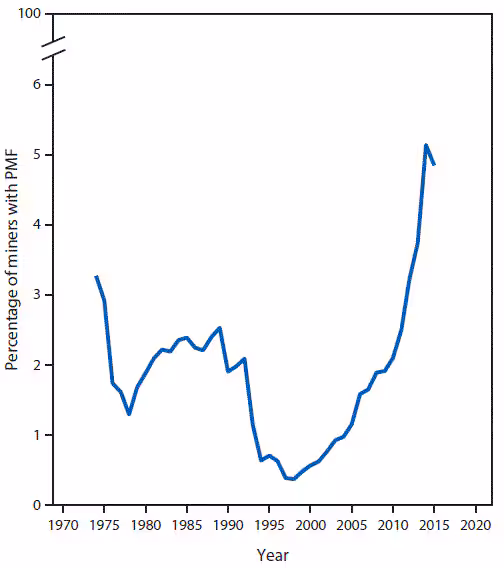 m6549a1f1.gif The figure above is a line chart showing the prevalence of progressive massive fibrosis among underground-working coal miners with ≥25 years of underground mining tenure in the Coal Workers’ Health Surveillance Program, located in Kentucky, Virginia, and West Virginia, during 1974–2015.