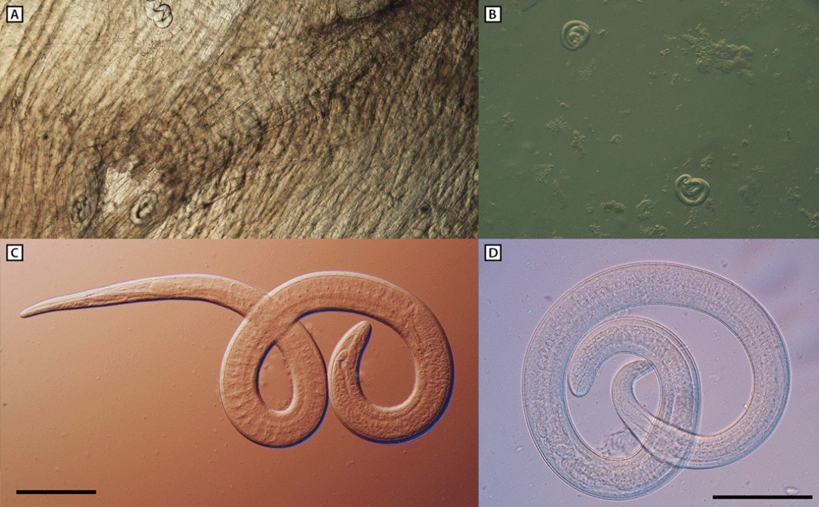 Outbreak of Human Trichinellosis — Arizona, Minnesota, and South Dakota, 2022 The figure is a series of four photographs illustrating microscopic examination of encapsulated larvae in a direct black bear meat muscle squash prep (A), larvae liberated from artificial digested bear meat (B), motile larvae viewed with differential interference contrast microscopy (C and D) from black bear meat suspected as the source of an outbreak of human Trichinella nativa infections in Arizona, Minnesota, and South Dakota in 2022.